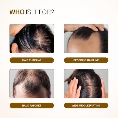 Reviewing the Bare Anatomy Advanced Hair Growth Serum Roll-On