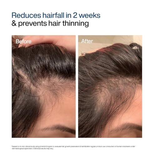 WishCare Hair Growth Serum Roll On Review